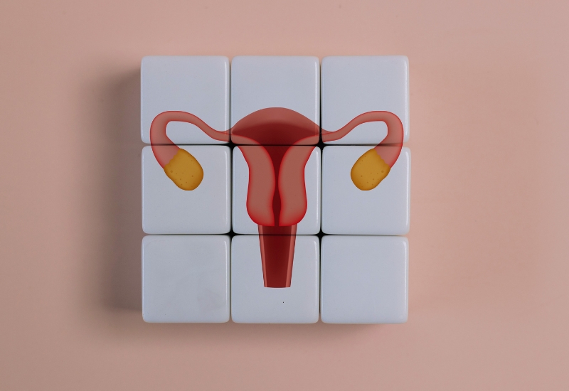 PCOS